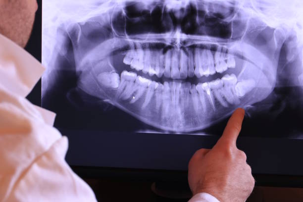 Best Emergency Dental Care for Abscessed Tooth in Rancho Palos Verdes, CA